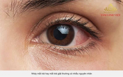Giật mắt trái, nháy mắt trái điềm gì, tốt hay xấu?